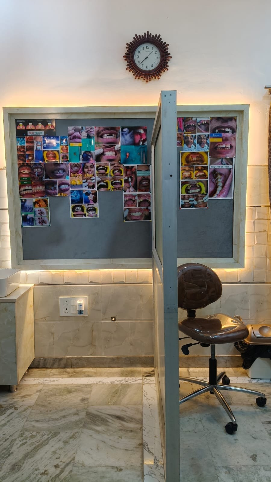 Treatment room with patient case displays at Wisdom Dental & Maxillofacial Centre, Moradabad