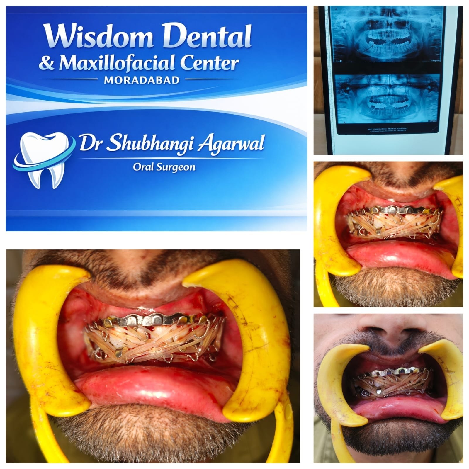 Dental X-ray and maxillofacial surgery results at Wisdom Dental & Maxillofacial Centre